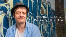 The Man with a Penis on His Arm